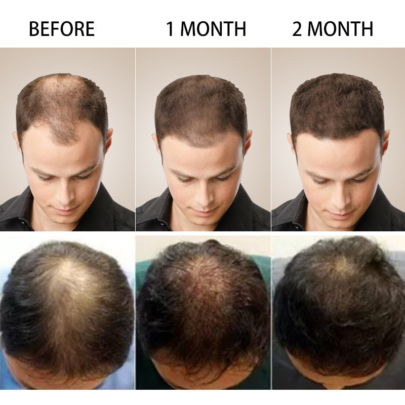 Essenz für schnelles Haarwachstum, natürliche pflanzliche Gesundheitsbehandlung