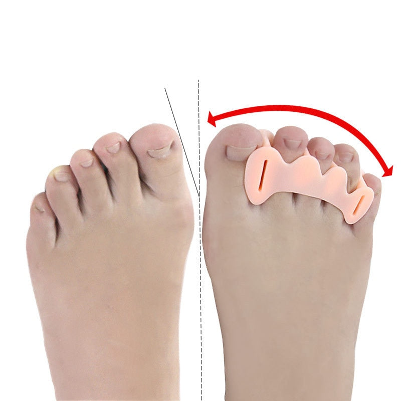 2Pcs=1Pair harte Silikon Zehentrenner, Hallux Valgus orthopädische Zehentrenner.