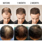 Essenz für schnelles Haarwachstum, natürliche pflanzliche Gesundheitsbehandlung