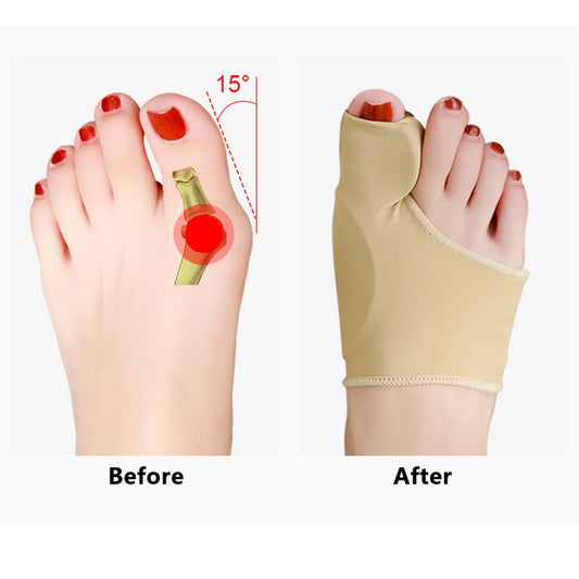 2Pcs Zehentrenner Hallux Valgus Korrektor, Separator für Zehen